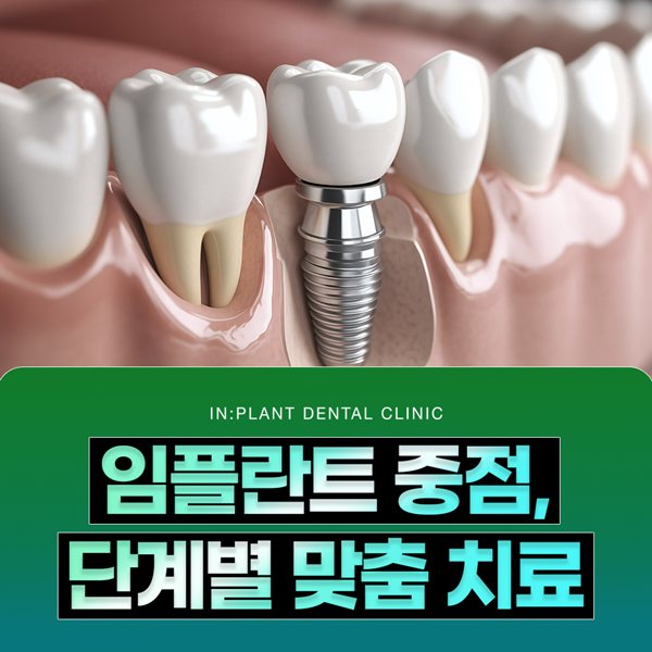 임플란트 중점, 단계별 맞춤 치료