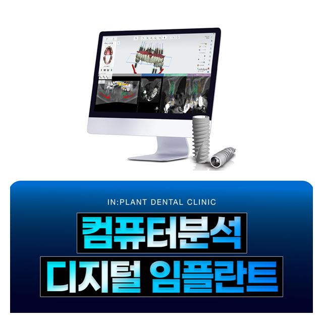컴퓨터분석 디지털 임플란트는 정교한 치료가 가능합니다